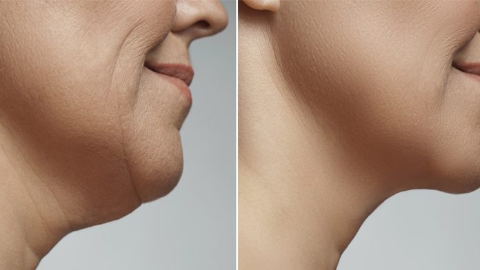 Lipopapada
